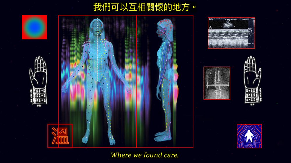 A digital illustration with various elements floating on a black background. To the center left of the composition is a large digital rendering of a slender gray figure with medium-length hair standing with their arms held away from the sides of their body as if being scanned. We see the figure both from the front and from the side with dotted lines running the length of the bodies, rainbow colored heat thermals also overlap the two bodies. The body scans are surrounded by floating illustrations including hands, an X-ray of a spine with metal rods, and a small blue-green orb on a red background.