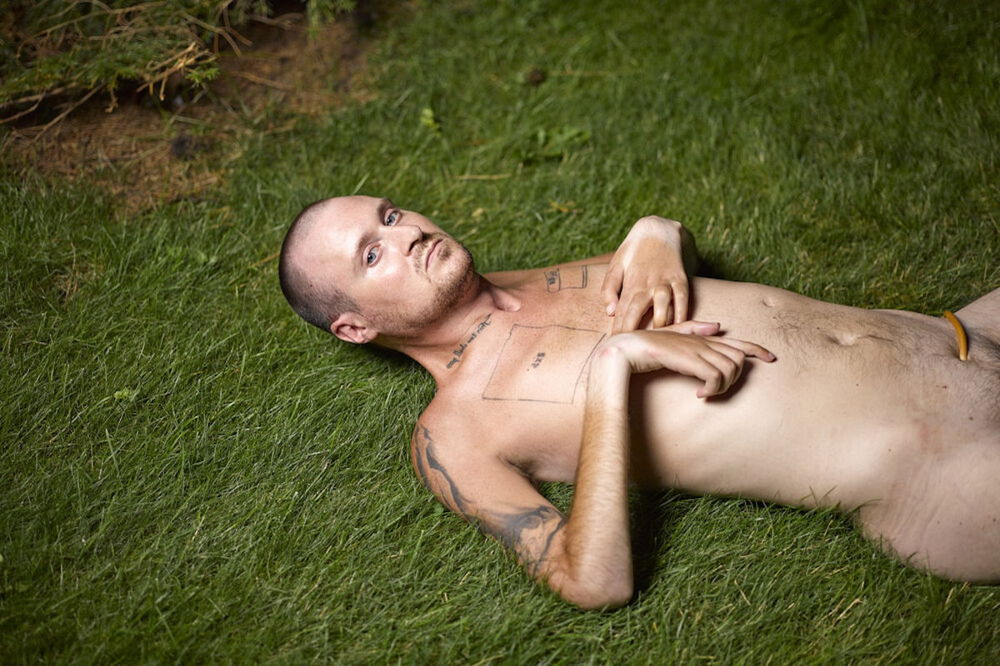 A photograph of a White disabled man laying horizontally, center right of the image, on a manicured lawn. His chest and arms are tattooed, and the image is cropped just below a yellow tube that is inserted in the man’s groin. He looks directly into the camera.